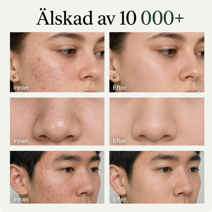 Refine™ Djuprengörande Lermask