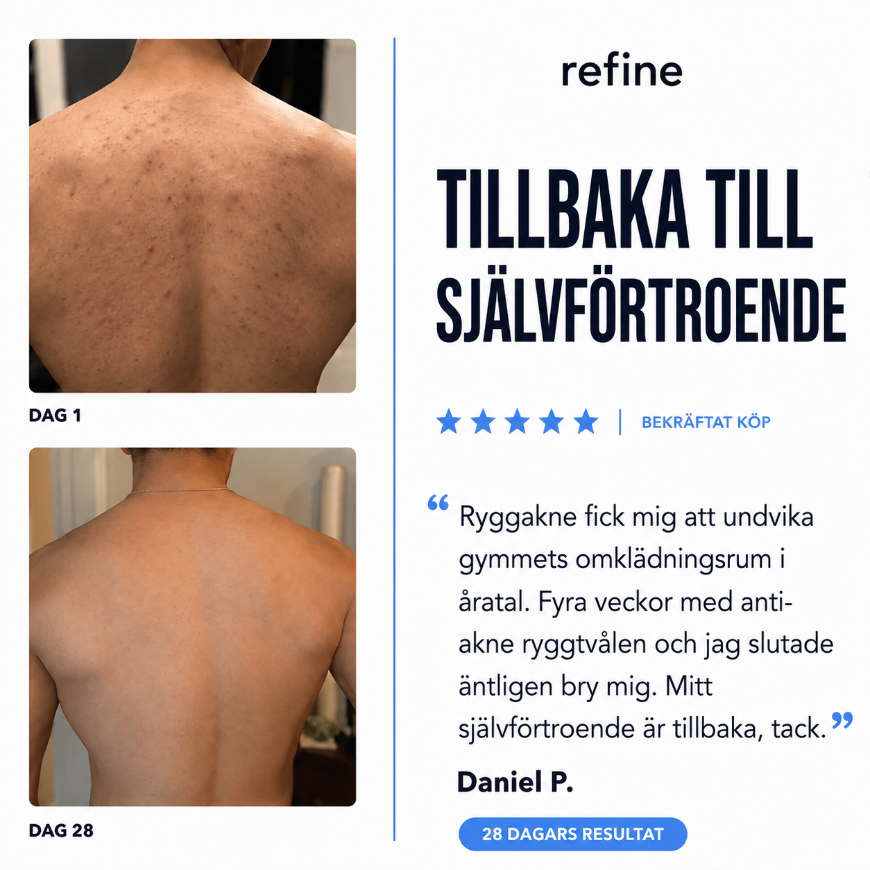 Refine™ Anti-Akne Kroppstvål